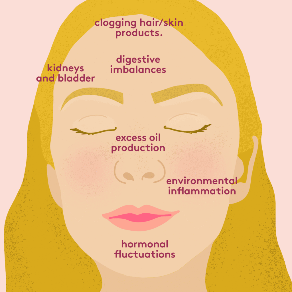 Why Acne Occurs On Face