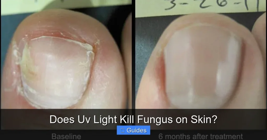 Does Uv Light Kill Fungus on Skin?